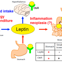 Leptin therapist weightloss